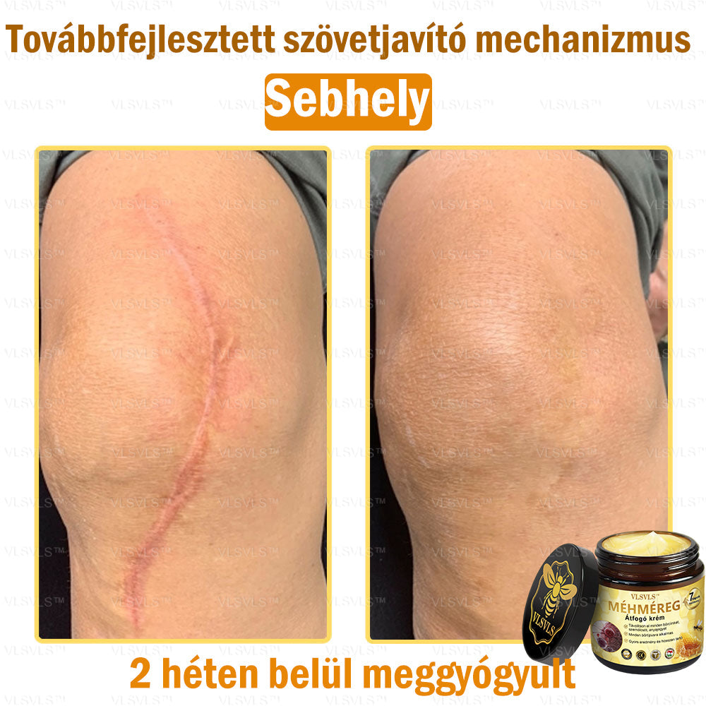 ⏰ Már csak 5 doboz maradt! További 50% kedvezményt biztosítunk! Legyen fitt és egészséges. Ha most veszít, csak jövőre lesz esélye.