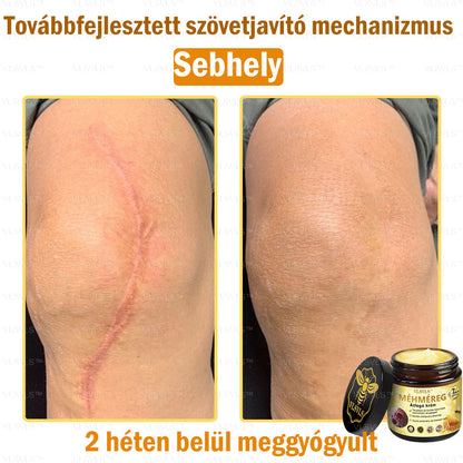 ⏰ Már csak 5 doboz maradt! További 50% kedvezményt biztosítunk! Legyen fitt és egészséges. Ha most veszít, csak jövőre lesz esélye.