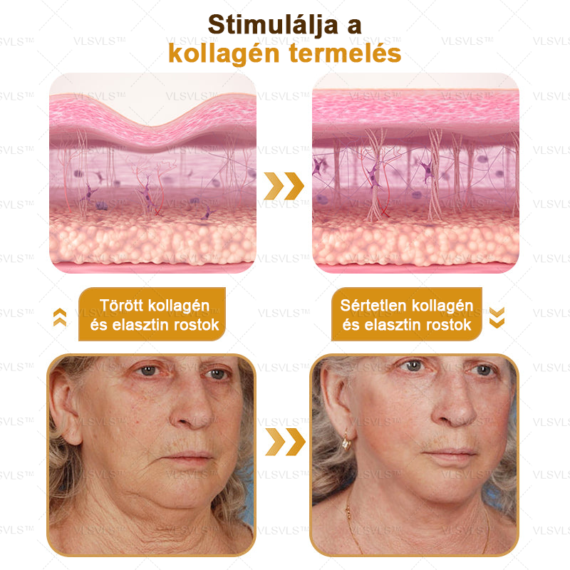 ✨𝑯𝒊𝒗𝒂𝒕𝒂𝒍𝒐𝒔 𝒃𝒐𝒍𝒕: PLTOWE™ Botox méhméreg ránctalanító krém🍀（Az akció utolsó napja: 50% kedvezmény）