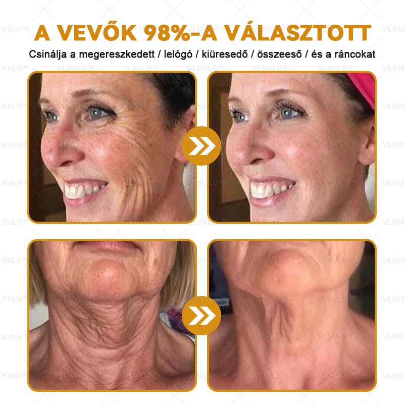 ✨𝑯𝒊𝒗𝒂𝒕𝒂𝒍𝒐𝒔 𝒃𝒐𝒍𝒕: PLTOWE™ Botox méhméreg ránctalanító krém🍀（Az akció utolsó napja: 50% kedvezmény）