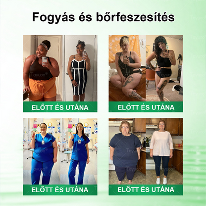 Hivatalos Webáruház | 👑👑 𝐓𝙖𝙮𝒖𝙤𝙤®  𝗠𝗼𝗿𝗶𝗻𝗴𝗮 ·𝑩𝒆𝒓𝒃𝒆𝒓𝒊𝒏𝒆 × 𝗡𝗔𝗗 𝗞𝗮𝗿𝗰𝘀ú𝘀í𝘁ó é𝙨 𝒃é𝒍𝒓𝒆𝒏𝒅𝒔𝒛𝒆𝒓𝒊 𝐞𝐠é𝐬𝐳𝐬é𝐠𝐞𝐭 𝒆𝒍ő𝒔𝒆𝒈í𝒕ő 𝙣𝙖𝙣𝙤 𝗺𝗶𝗸𝗿𝗼𝘁ű𝘀 𝒕𝒂𝒑𝒂𝒔𝒛 🇭🇺  (𝙉𝙖𝙥𝙤𝙣𝙩𝙖 𝙘𝙨𝙖𝙠 𝙚𝙜𝙮𝙨𝙯𝙚𝙧 — 𝙖𝙯 𝙚𝙡𝙨ő 𝙡á𝙩𝙝𝙖𝙩ó 𝙫á𝙡𝙩𝙤𝙯á𝙨𝙤𝙠 𝙢á𝙧 7 𝙣𝙖𝙥 𝙪𝙩á𝙣) ✅  Átfogó támogatás az alakformáláshoz