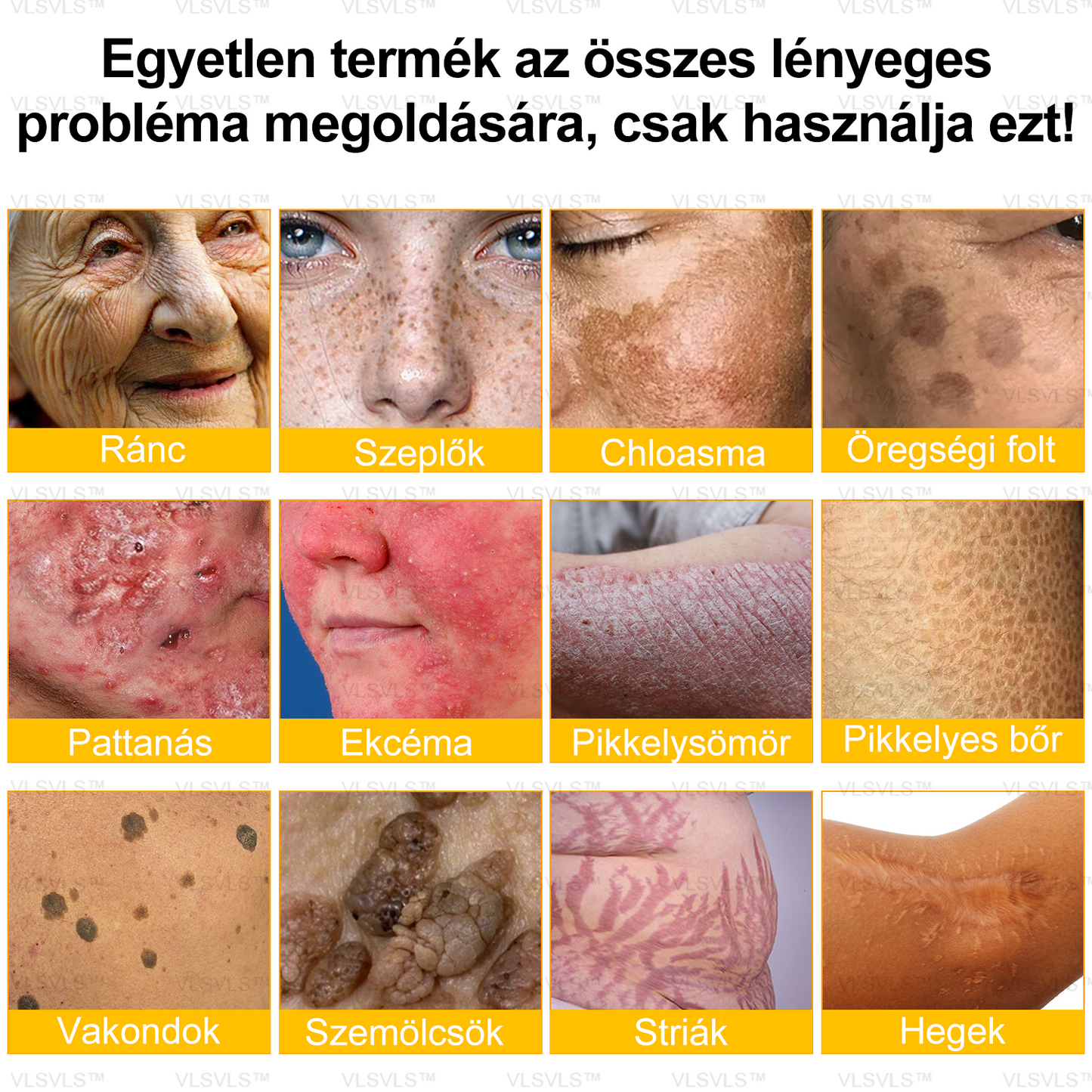 ⏰ Már csak 5 doboz maradt! További 50% kedvezményt biztosítunk! Legyen fitt és egészséges. Ha most veszít, csak jövőre lesz esélye.