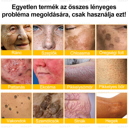 ⏰ Már csak 5 doboz maradt! További 50% kedvezményt biztosítunk! Legyen fitt és egészséges. Ha most veszít, csak jövőre lesz esélye.