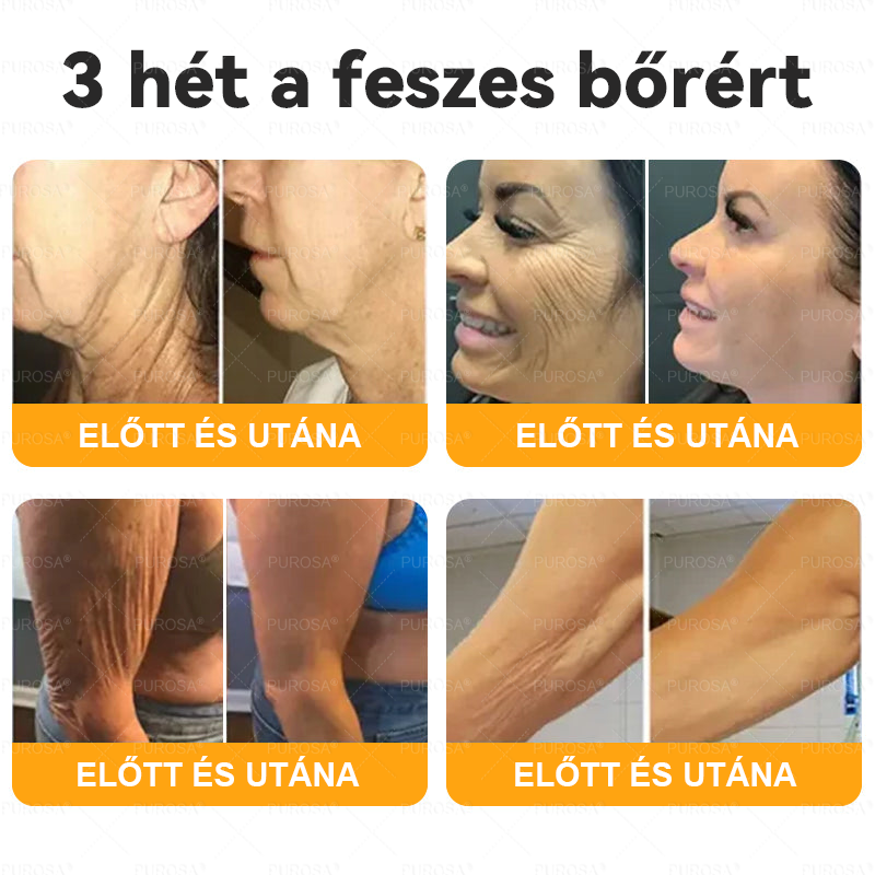 Magyarországról készült és szállított✨🌿PUROSA® Méhméreg Bőrfelújító Krém 🔥 UTOLSÓ NAP – 80% KEDVEZMÉNY🔥