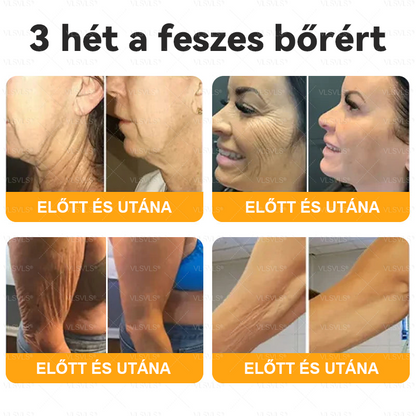 Magyarországról készült és szállított🌸VLSVLS® Méhméreg Bőrfelújító Krém 🔥🔥 UTOLSÓ NAP – 80% KEDVEZMÉNY