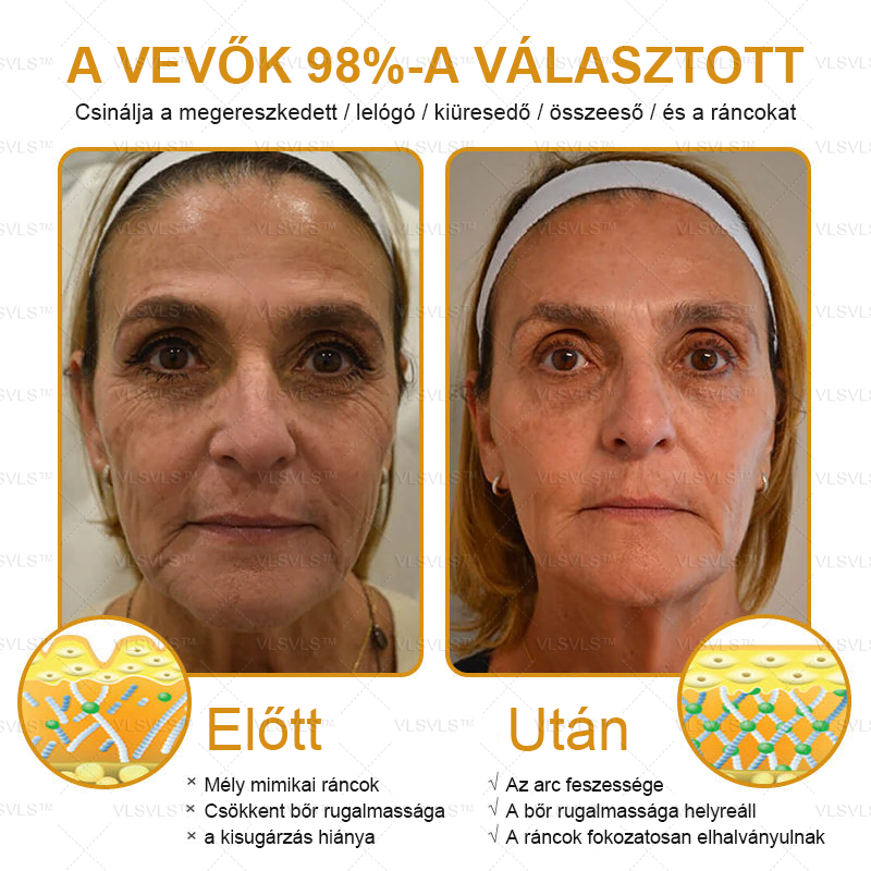 ✨𝑯𝒊𝒗𝒂𝒕𝒂𝒍𝒐𝒔 𝒃𝒐𝒍𝒕: PLTOWE™ Botox méhméreg ránctalanító krém🍀（Az akció utolsó napja: 50% kedvezmény）