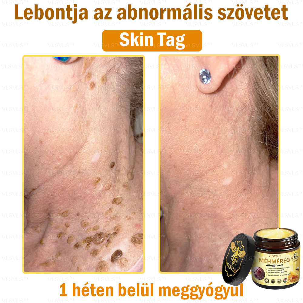 ⏰ Már csak 5 doboz maradt! További 50% kedvezményt biztosítunk! Legyen fitt és egészséges. Ha most veszít, csak jövőre lesz esélye.