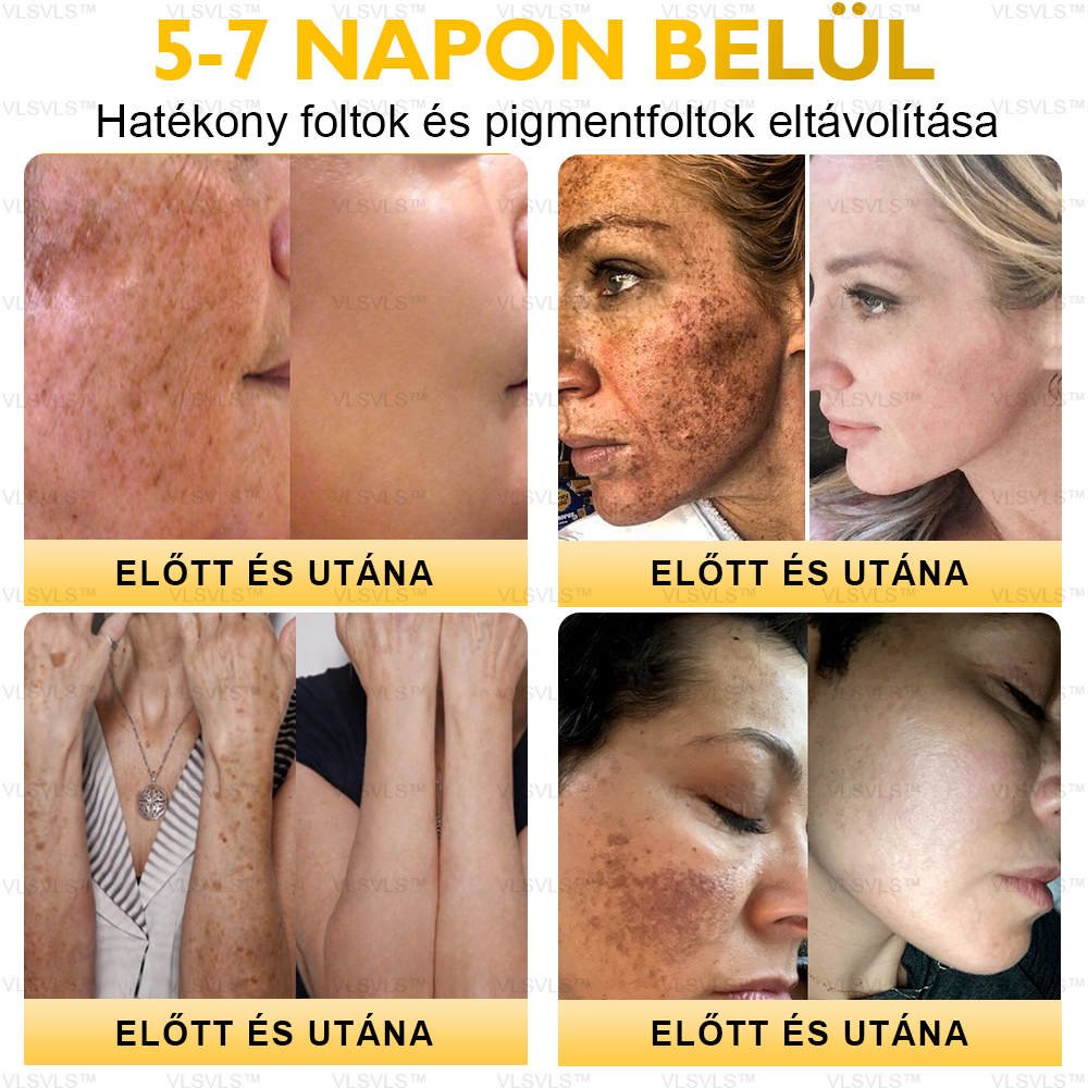 ⏰ Már csak 5 doboz maradt! További 50% kedvezményt biztosítunk! Legyen fitt és egészséges. Ha most veszít, csak jövőre lesz esélye.