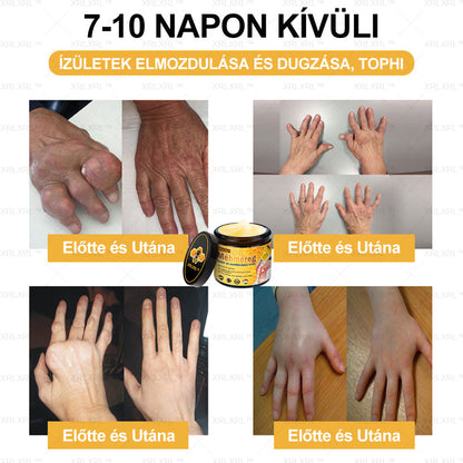 𝗫𝗥𝑳𝑿𝐑𝐋™ 𝗺é𝗵𝗺é𝐫𝐞𝐠 𝐟á𝗷𝗱𝗮𝗹𝗼𝒎𝒄𝒔𝒊𝒍𝒍𝒂𝒑í𝒕ó 𝗰𝘀𝗼𝗻𝘁𝗴𝒚ó𝐠𝐲í𝐭ó 𝐤𝐫é𝒎 (különösen alkalmas idősek számára, a Magyar Ortopédiai Társaság ajánlása alapján)