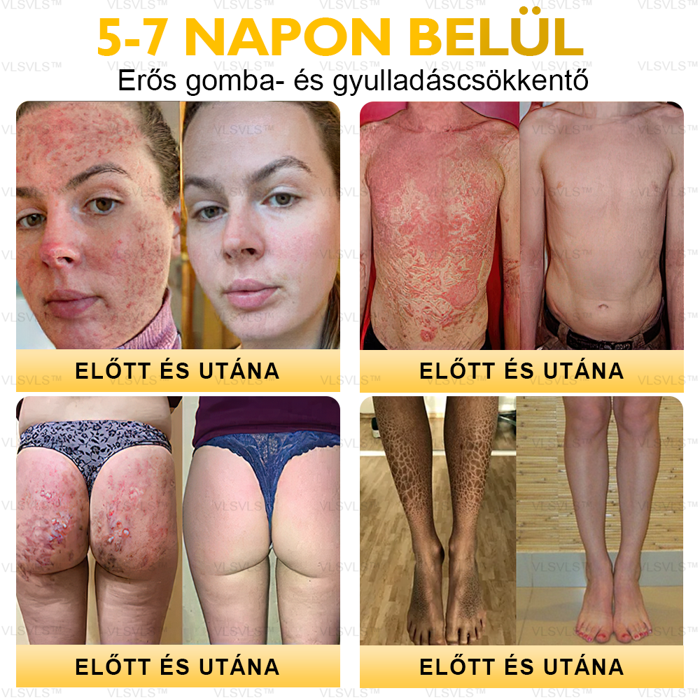 ⏰ Már csak 5 doboz maradt! További 50% kedvezményt biztosítunk! Legyen fitt és egészséges. Ha most veszít, csak jövőre lesz esélye.