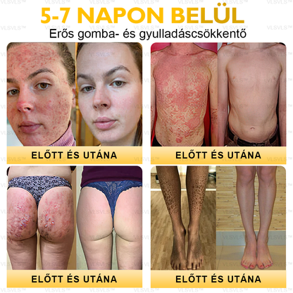 ⏰ Már csak 5 doboz maradt! További 50% kedvezményt biztosítunk! Legyen fitt és egészséges. Ha most veszít, csak jövőre lesz esélye.