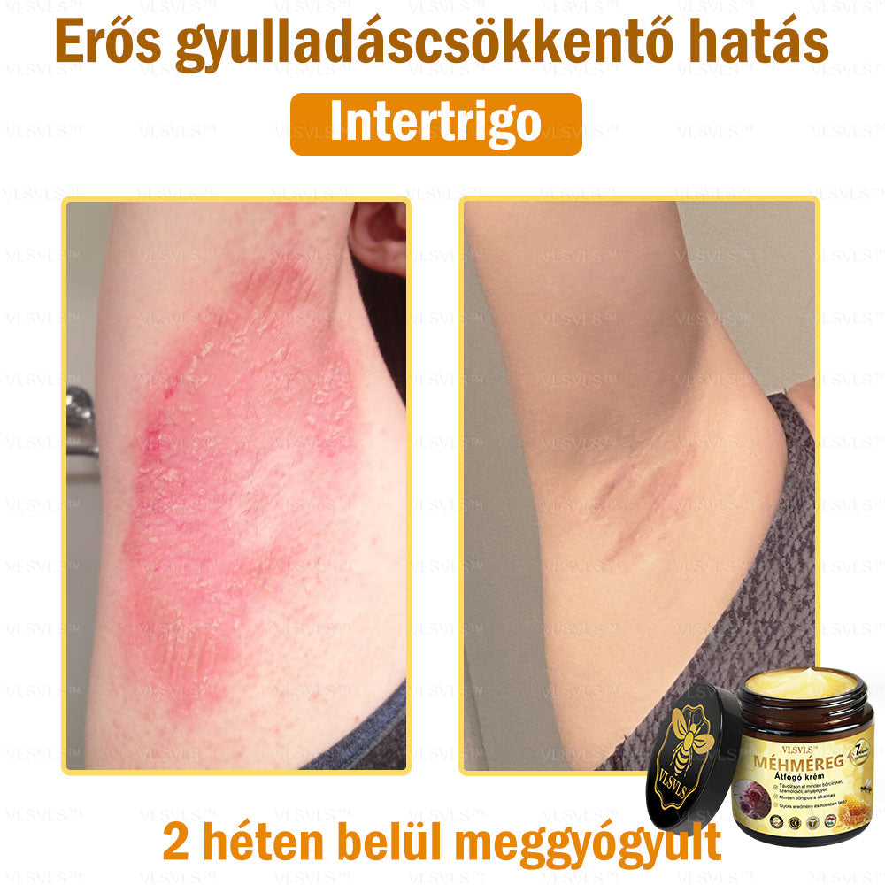 ⏰ Már csak 5 doboz maradt! További 50% kedvezményt biztosítunk! Legyen fitt és egészséges. Ha most veszít, csak jövőre lesz esélye.