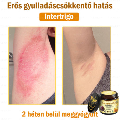 ⏰ Már csak 5 doboz maradt! További 50% kedvezményt biztosítunk! Legyen fitt és egészséges. Ha most veszít, csak jövőre lesz esélye.