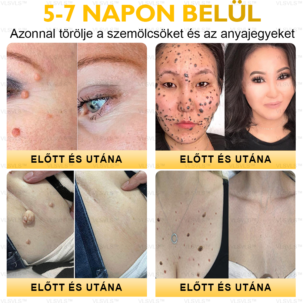 ⏰ Már csak 5 doboz maradt! További 50% kedvezményt biztosítunk! Legyen fitt és egészséges. Ha most veszít, csak jövőre lesz esélye.