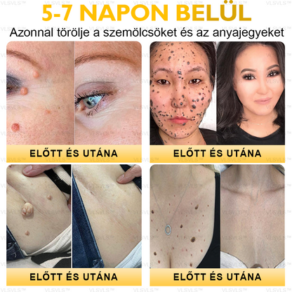 ⏰ Már csak 5 doboz maradt! További 50% kedvezményt biztosítunk! Legyen fitt és egészséges. Ha most veszít, csak jövőre lesz esélye.