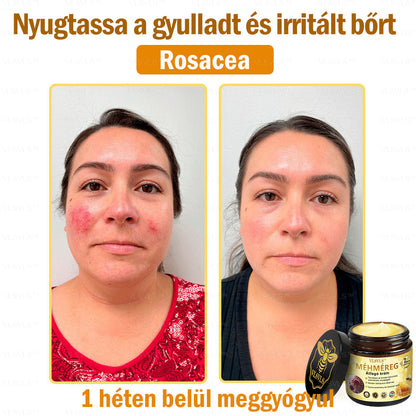 ⏰ Már csak 5 doboz maradt! További 50% kedvezményt biztosítunk! Legyen fitt és egészséges. Ha most veszít, csak jövőre lesz esélye.