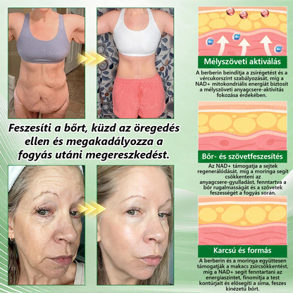 Hivatalos Webáruház | 👑👑 𝐓𝙖𝙮𝒖𝙤𝙤®  𝗠𝗼𝗿𝗶𝗻𝗴𝗮 ·𝑩𝒆𝒓𝒃𝒆𝒓𝒊𝒏𝒆 × 𝗡𝗔𝗗 𝗞𝗮𝗿𝗰𝘀ú𝘀í𝘁ó é𝙨 𝒃é𝒍𝒓𝒆𝒏𝒅𝒔𝒛𝒆𝒓𝒊 𝐞𝐠é𝐬𝐳𝐬é𝐠𝐞𝐭 𝒆𝒍ő𝒔𝒆𝒈í𝒕ő 𝙣𝙖𝙣𝙤 𝗺𝗶𝗸𝗿𝗼𝘁ű𝘀 𝒕𝒂𝒑𝒂𝒔𝒛 🇭🇺  (𝙉𝙖𝙥𝙤𝙣𝙩𝙖 𝙘𝙨𝙖𝙠 𝙚𝙜𝙮𝙨𝙯𝙚𝙧 — 𝙖𝙯 𝙚𝙡𝙨ő 𝙡á𝙩𝙝𝙖𝙩ó 𝙫á𝙡𝙩𝙤𝙯á𝙨𝙤𝙠 𝙢á𝙧 7 𝙣𝙖𝙥 𝙪𝙩á𝙣) ✅  Átfogó támogatás az alakformáláshoz
