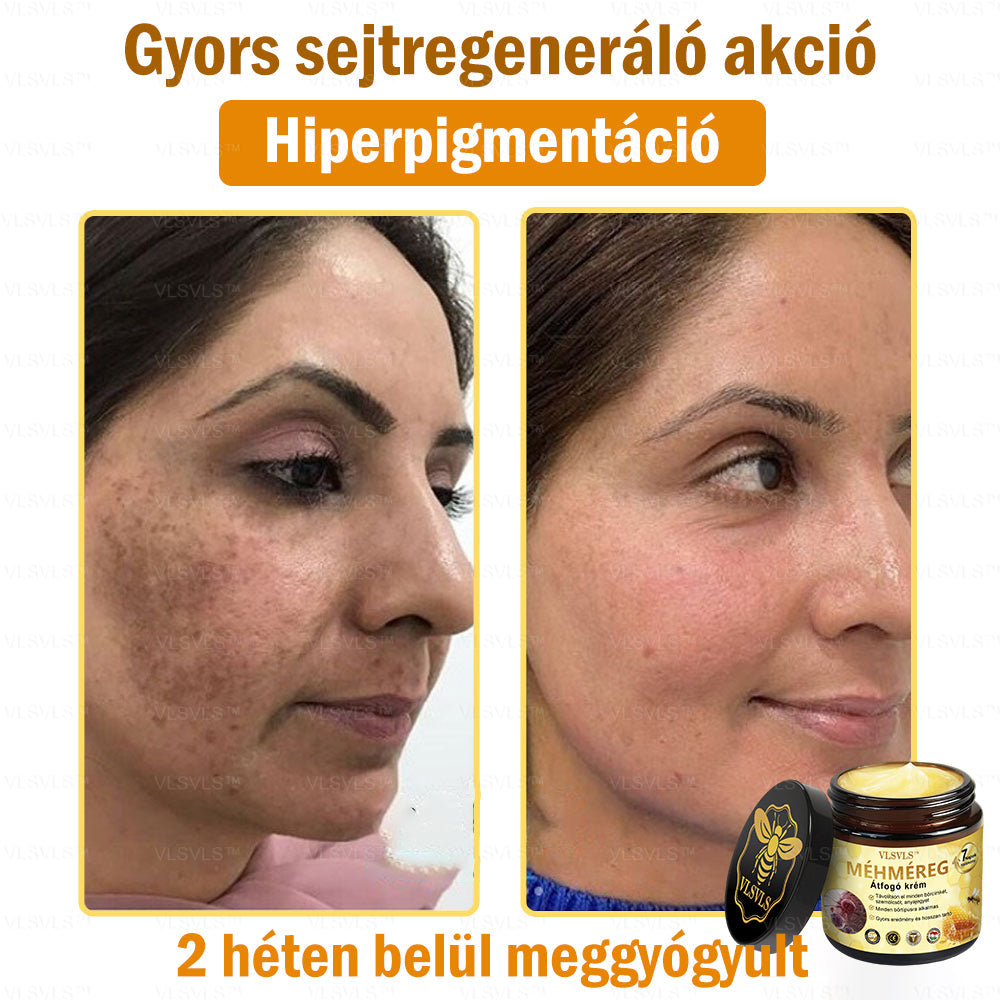 ⏰ Már csak 5 doboz maradt! További 50% kedvezményt biztosítunk! Legyen fitt és egészséges. Ha most veszít, csak jövőre lesz esélye.